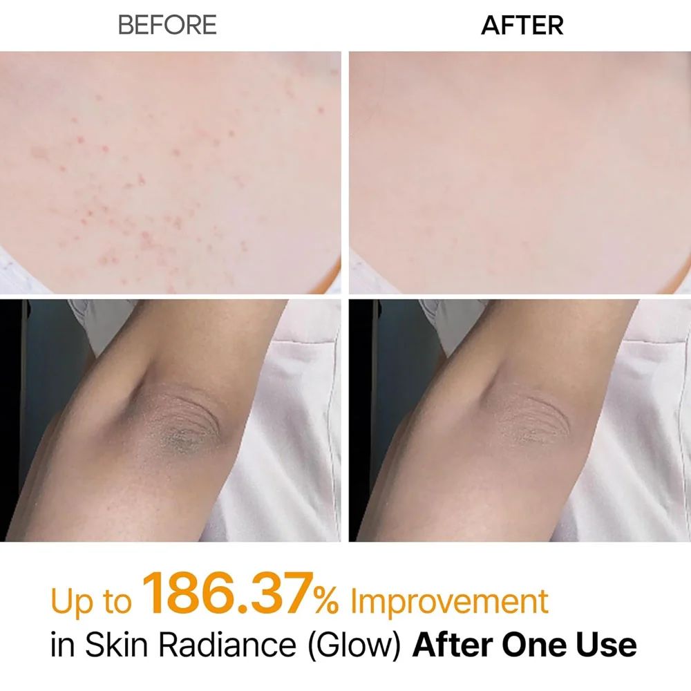 Dr.Melaxin Peel Shot PS | Kojic Acid & Turmeric Exfoliating Spray