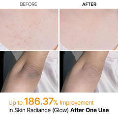 Dr.Melaxin Peel Shot PS | Kojic Acid & Turmeric Exfoliating Spray